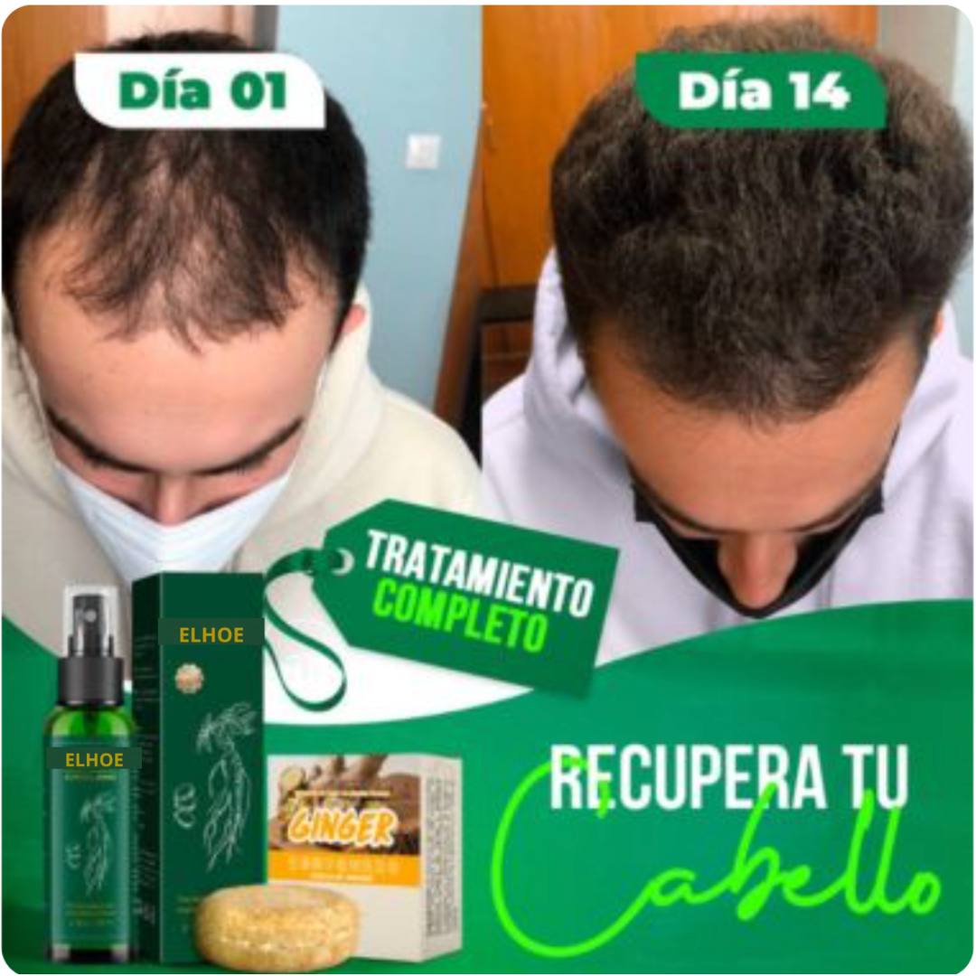 Tonico Elhoe Para La Caida De Cabello