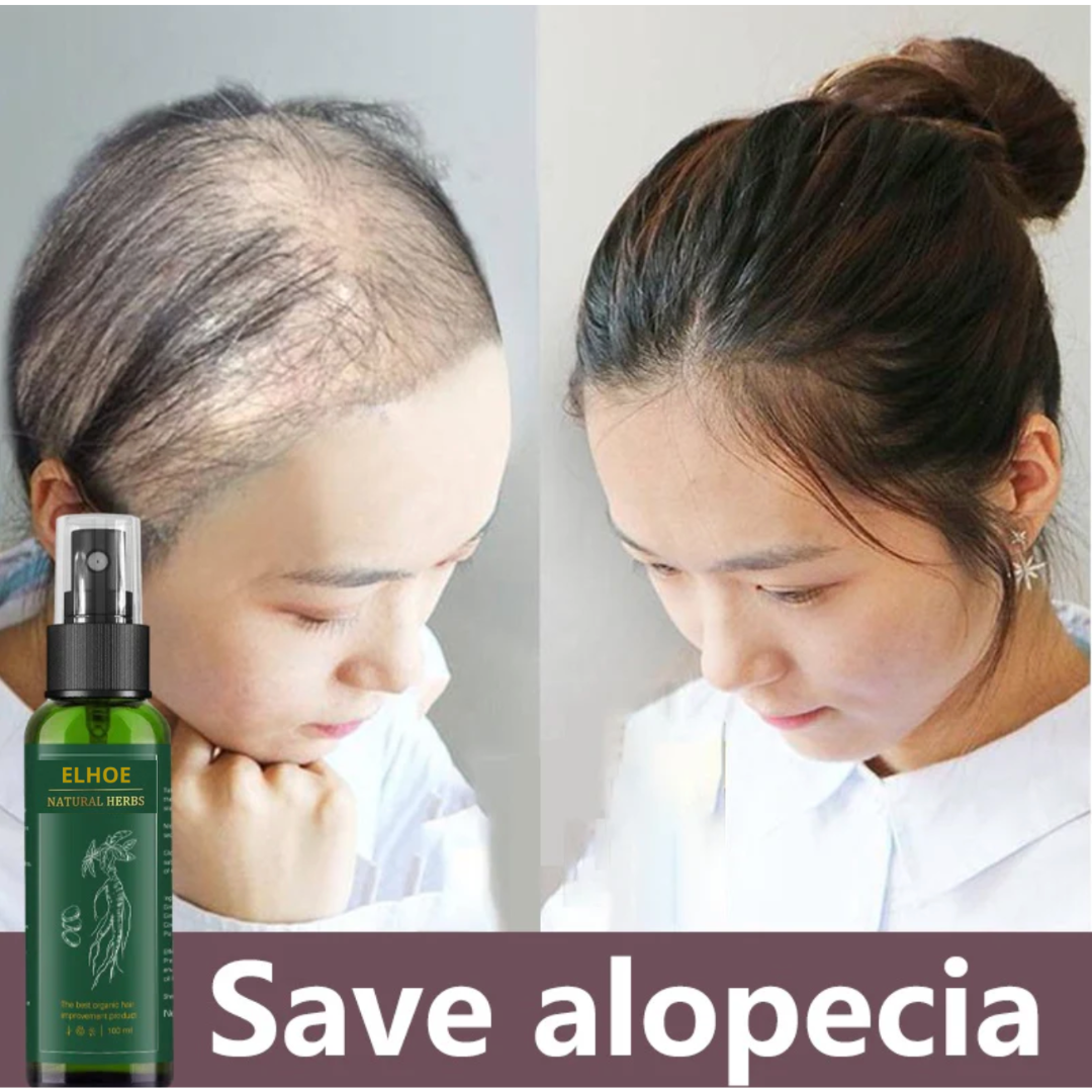 Tonico Elhoe Para La Caida De Cabello